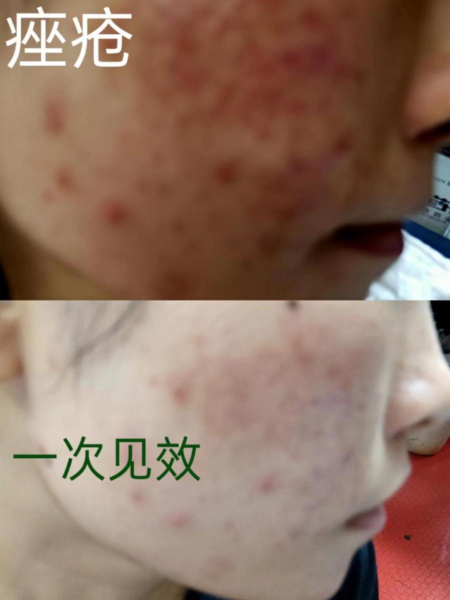 956510c8cf3cd016692deb4e60c1e89